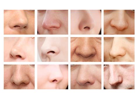 Different Kinds of Nose Jobs: Which Is Right for You?