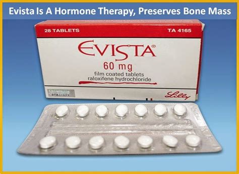 Exelon - Exelon buy sell or hold, exelon 3 mg rivastigmine, exelon ...