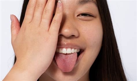What Causes Small Black Spots On Tongue - Infoupdate.org