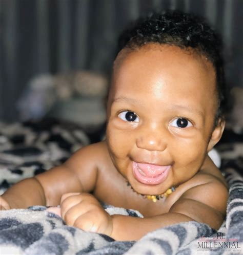 Cradle Cap : How To Treat It Fast - The Millennial Stay-At-Home Mom