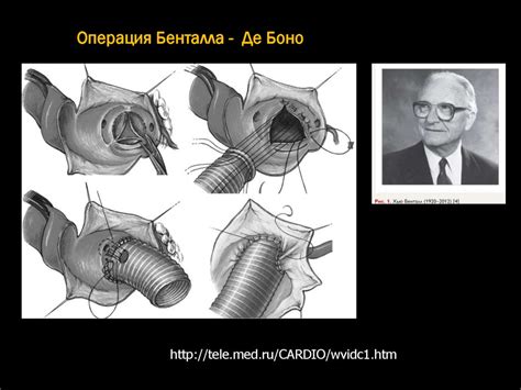 Приобретенные пороки сердца - презентация онлайн