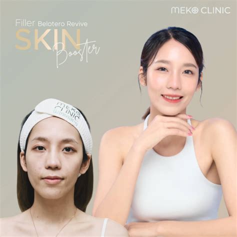 Belotero revive ฟิลเลอร์งานผิวที่เมโกะคลินิก - Meko Clinic