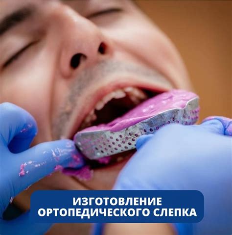 Instagram video by КЛИНИКА БОБРОВА 🦷 СТОМАТОЛОГИЯ | ГОМЕЛЬ • Dec 13 ...