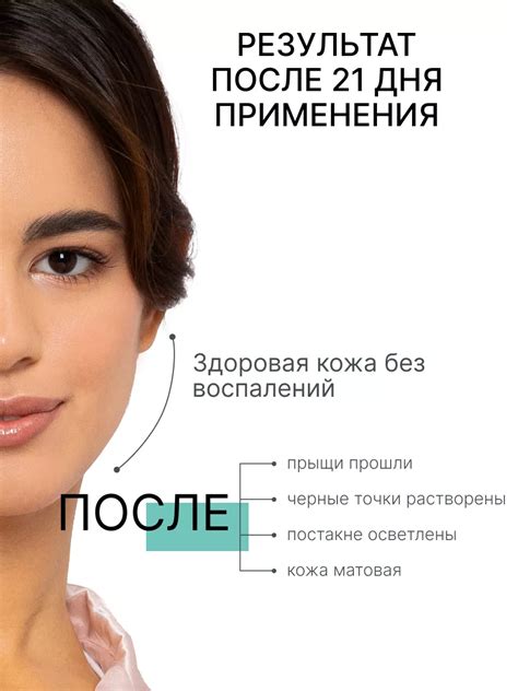 Сыворотка для лица от прыщей с ниацинамидом и цинком BLOOM COSMETICS ...