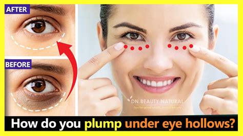 Hollow Under Eyes Makeup | Saubhaya Makeup