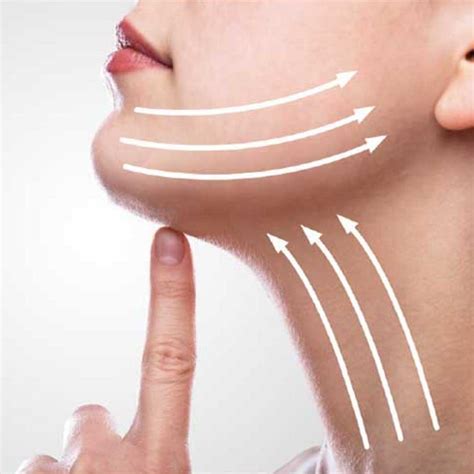 HIFU Chin - Australia HIFU