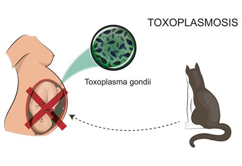 Toxoplasmosis during Pregnancy: Reasons, Signs & Treatment