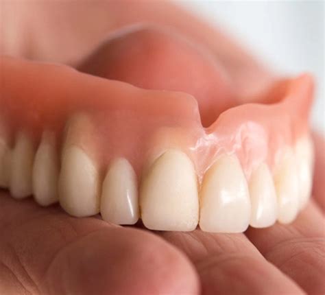 dentures service needham market dental practice