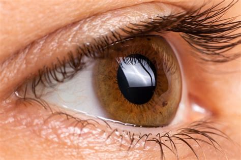 foto mata makro keratoconus penyakit mata penipisan kornea  bentuk