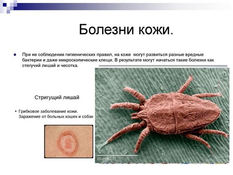 Гигиена кожи. Болезни кожи - презентация онлайн