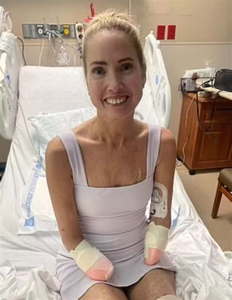 Woman who thought she had a sore throat ended up having all her limbs