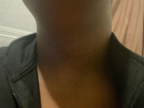 do anybody know why half of my skin is blacker then the rest of my skin