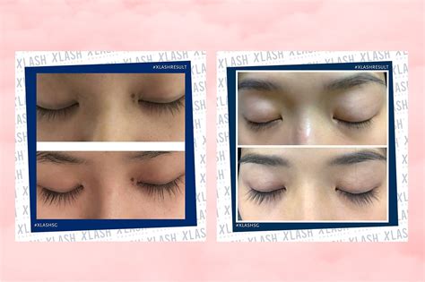 I Used An Eyelash Serum For 3 Months To See If I Could Grow Longer ...