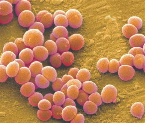 Staph infection - Mahaba Herbal Limited