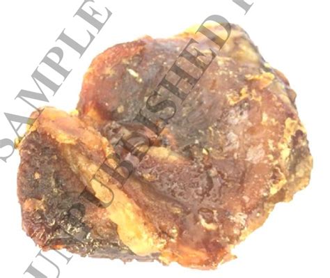 A picture of the preserved tissue shows the superficial fatty layer and ...