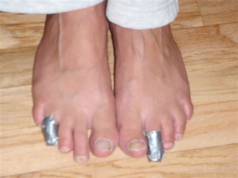 Sore Toes After Running Long Distance at Juan Maguire blog