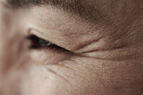 Causes of Dry, Itchy, and Flaky Skin