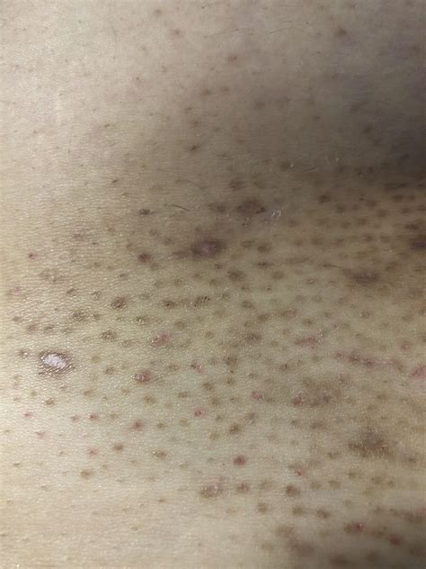does any one know how to fix my bikini line :( i’ve been struggling
