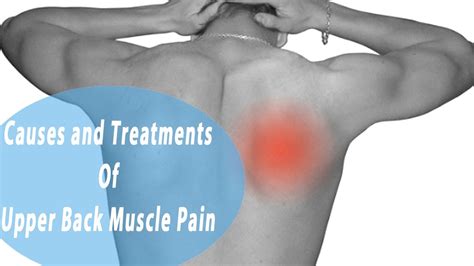 Upper Back Muscle Pain | Common Causes and Treatments Of Upper Back ...