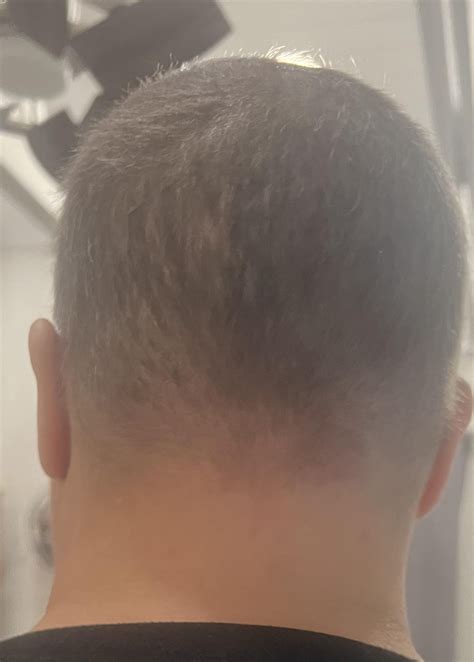 How fast does hair grow back? : r/cancer