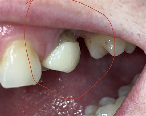 Hello Doctors! : r/askdentists