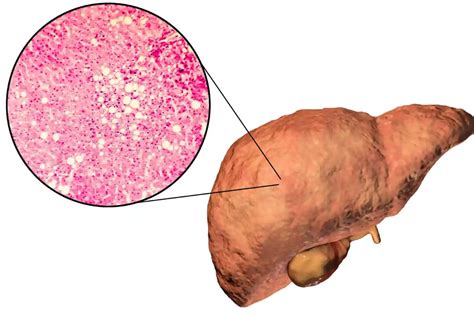 liver function test normal range alt ast alp bilirubin explained