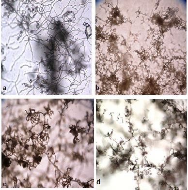 A view from spore chain morphology of Streptomyces strains | Download ...