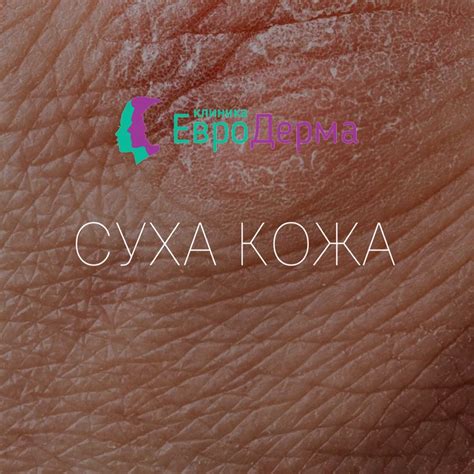 Клиника ЕвроДерма