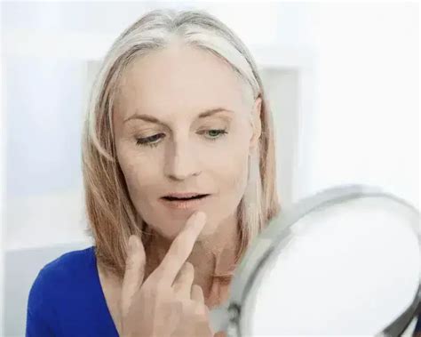 how to get rid of marionette lines at home