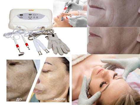 Unlock Your Skin's Radiant Potential: A Guide to Microcurrent Bio Lifting