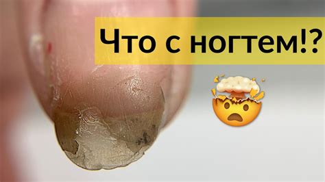 Выпуклые ногти - Комбинированный маникюр и Гель Лак | Ножницы ...