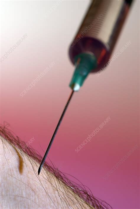 Injection - Stock Image - C001/6514 - Science Photo Library