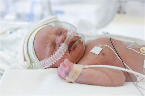 NIPPV and High-level Pulmonary Support in Neonates | Respiratory Therapy