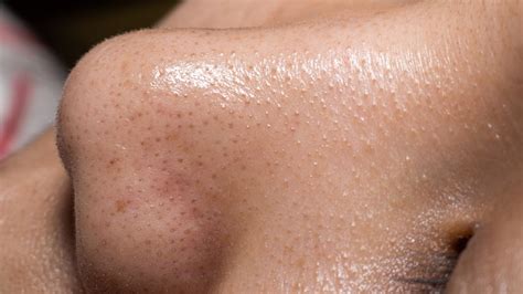 How To Regulate Sebaceous Filaments On Your Nose, According To Our ...