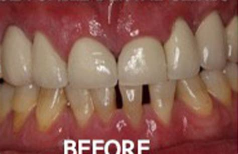 Bangkok Dental - Dentist by Bangkok Smile Dental Clinic in Thailand