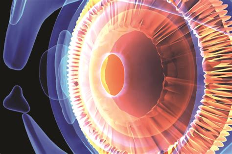 chronic open angle glaucoma case study  pharmaceutical journal