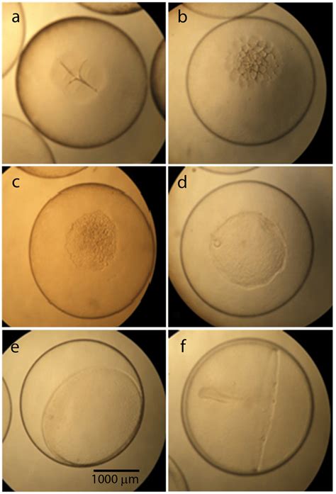 Morphology of Dissostichus eleginoides (Patagonian toothfish) embryos ...