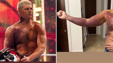 WWE star Cody Rhodes out for NINE MONTHS after having surgery on torn ...