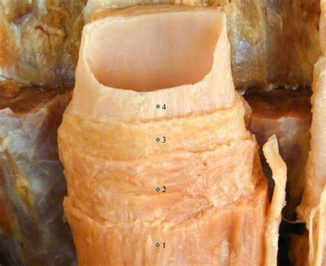 Esophagus Diagram | Quizlet