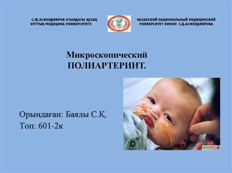 Микроскопический полиангиит - презентация онлайн