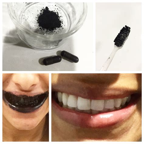 5 ways to whiten your teeth naturally! - Dr. Bindiya