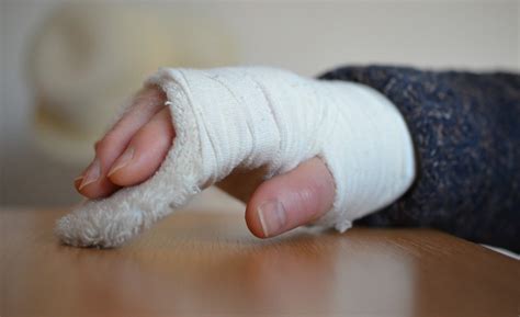 Hand Fractures Los Angeles | Hand Surgery Center of Los Angeles