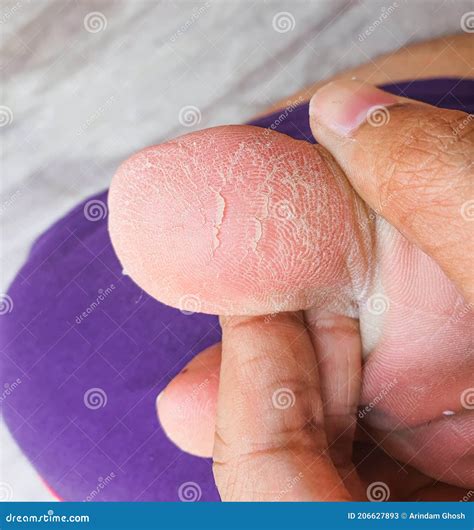 Closeup Shot of Cracked Skin of Heel of Foot.Pedicure Concept Image
