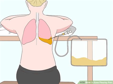 How to Ease Pleurisy Pain: 8 Steps (with Pictures) - wikiHow