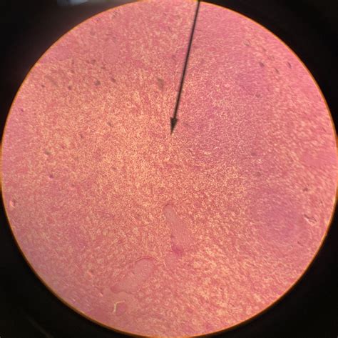 reticular connective tissue | Chicken wire, Tissue, Fiber