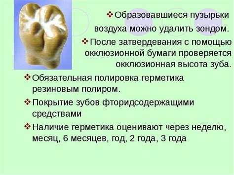 Герметизация фиссур - скачать презентацию