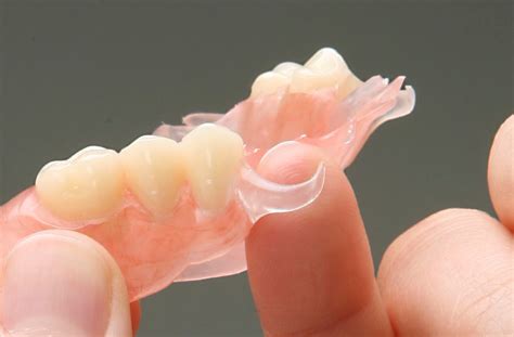 Flexible Partial Denture Repair