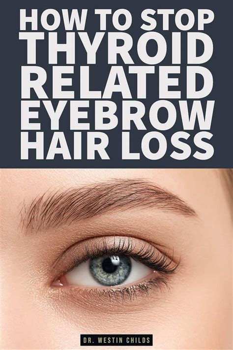 Can Thyroid Problems Cause Eyebrow Hair Loss? | Dr. Westin Childs