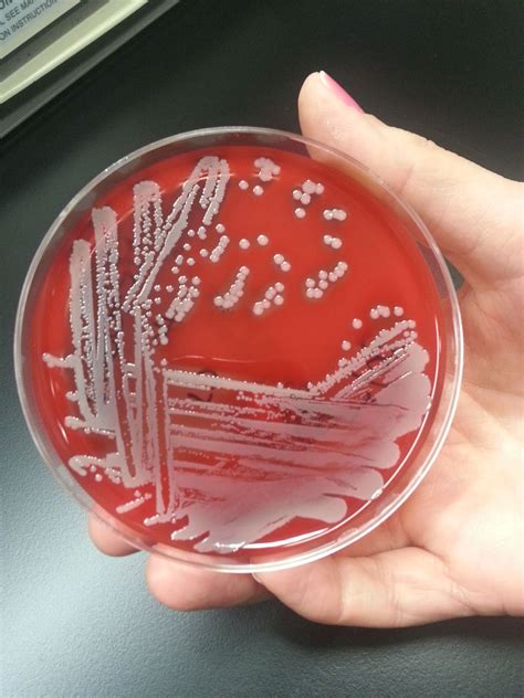 Staphylococcus_aureus_jpeg | MICROBIOLOGY MATTERS