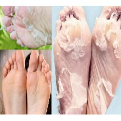 Отзыв о Носки педикюрные пилинговые MiFo Super Exfoliating Foot Socks ...